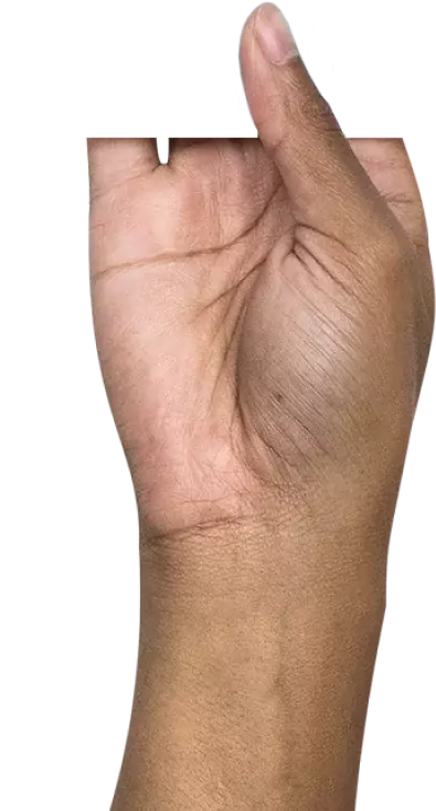 ręka