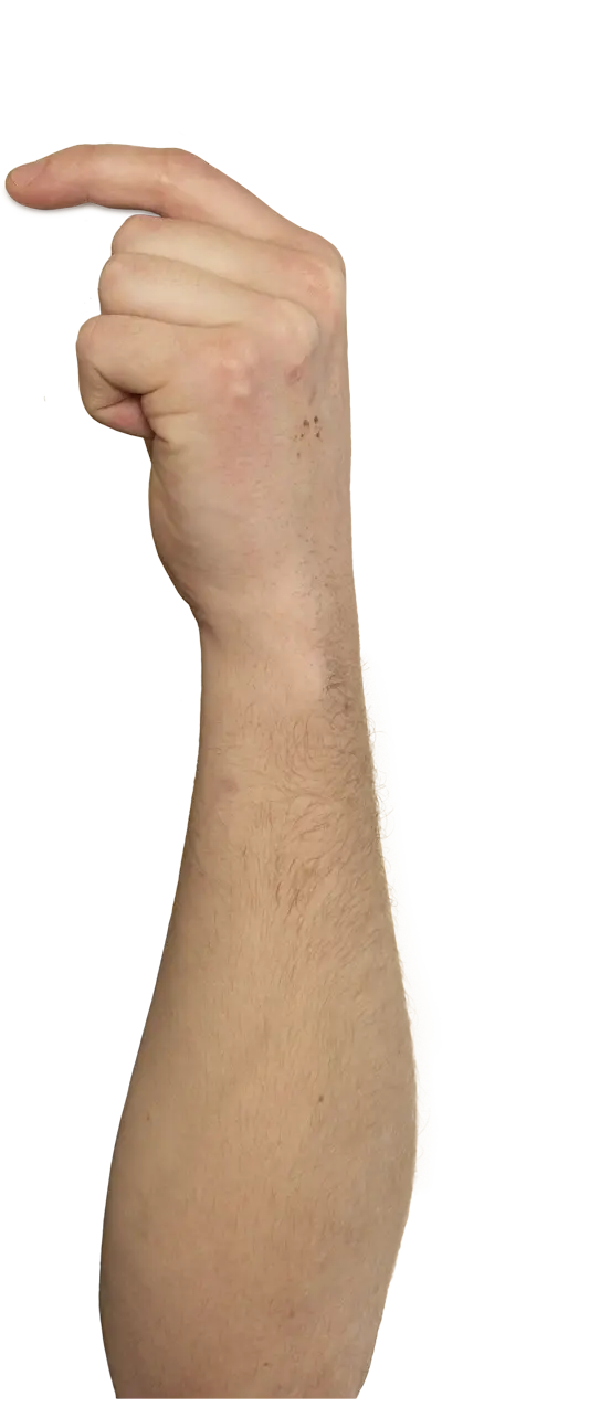 ręka